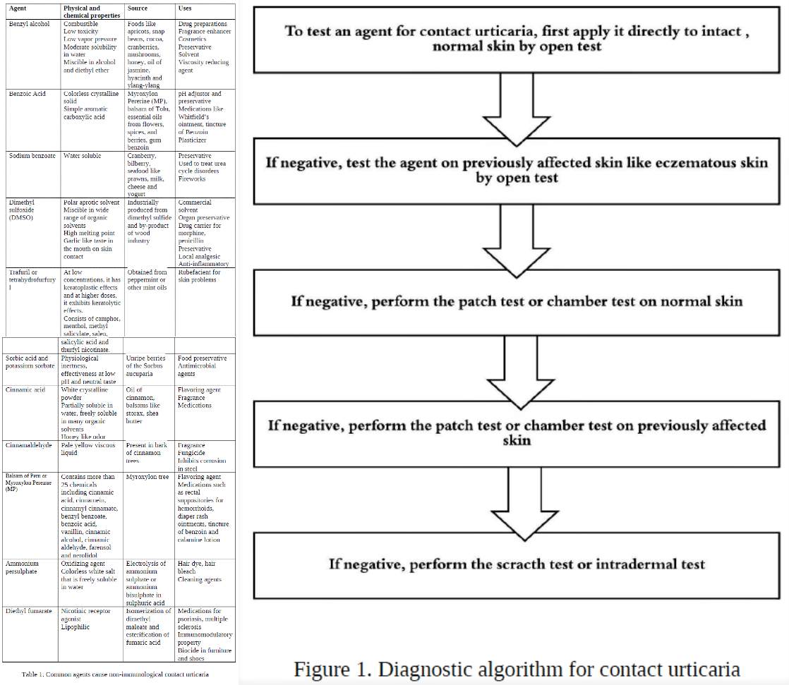 Acute Urticaria