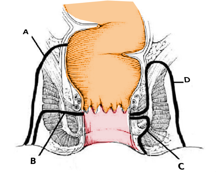 Park's classification of fistulas