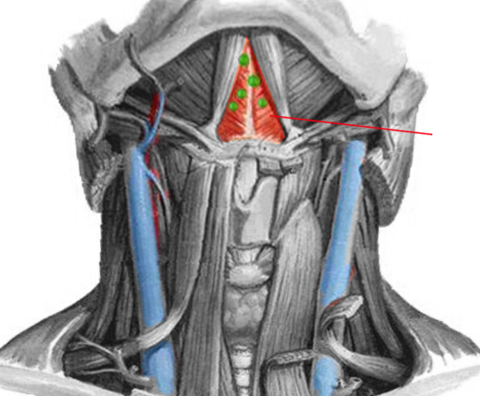 Submental triangle