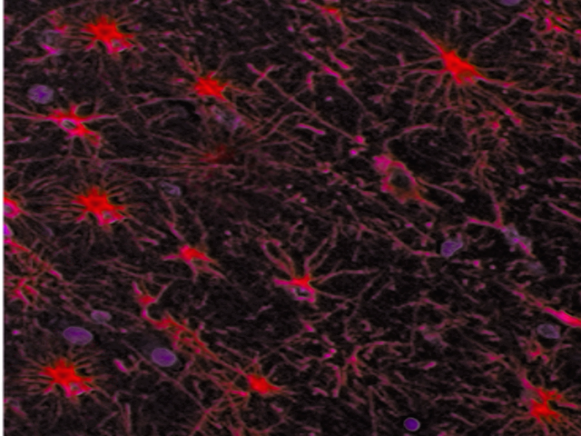 Astrocytes