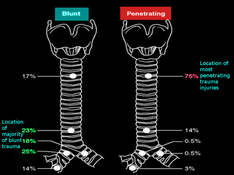 <p>Locations of Tracheal Injury</p>