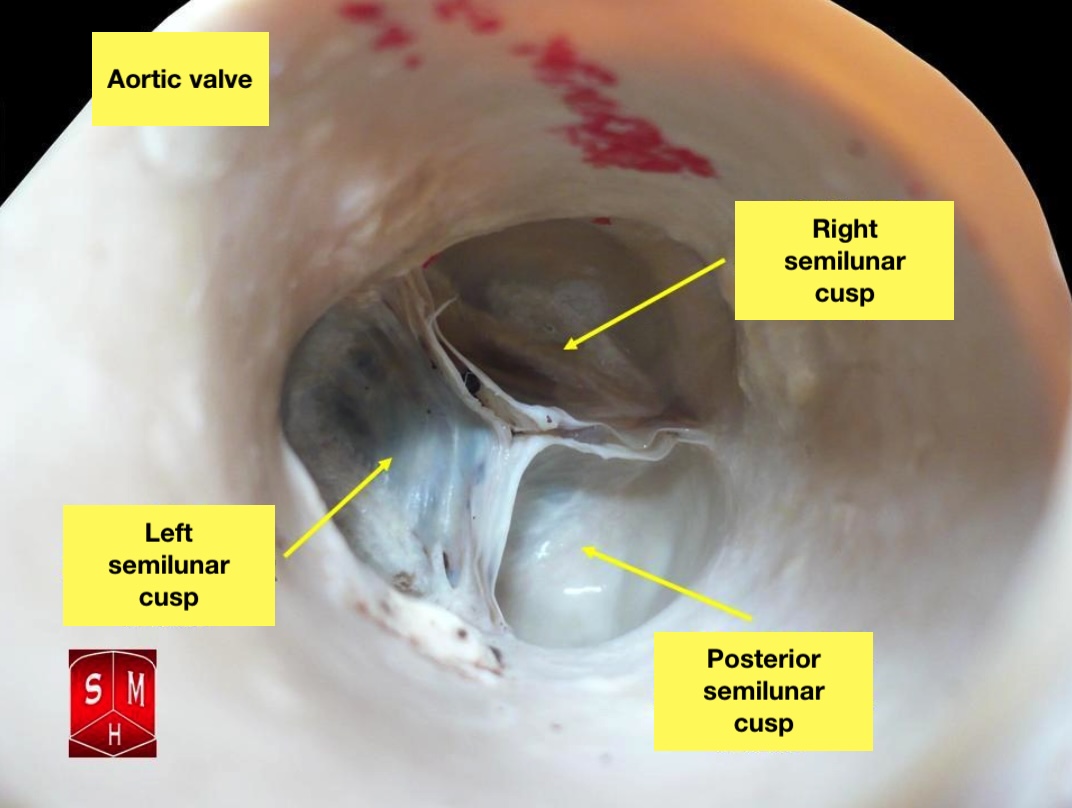 <p>The Aortic Valve