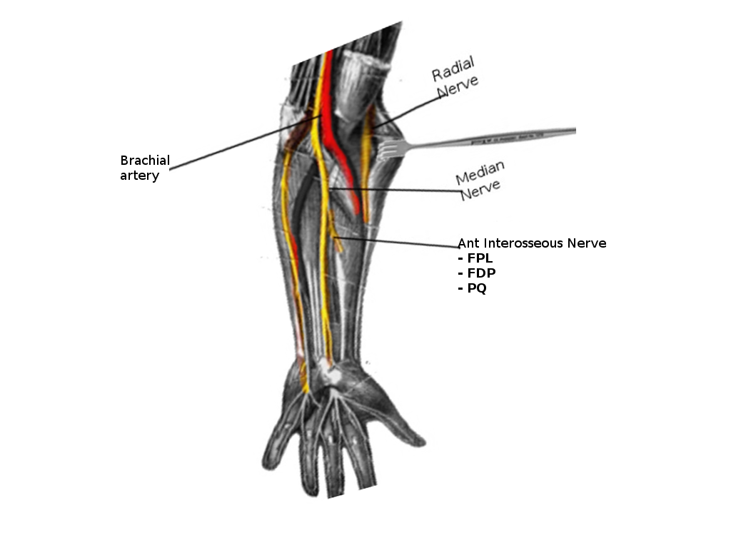 Anterior Interosseous Nerve