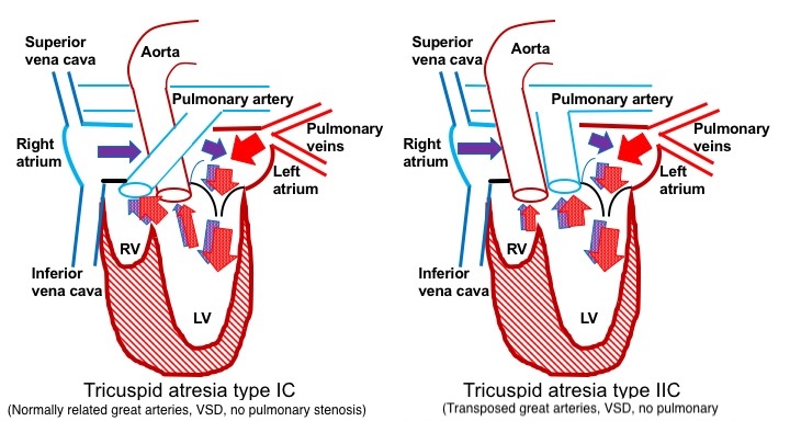 <p>Blood Flow in Patients Without Pulmonary Obstruction