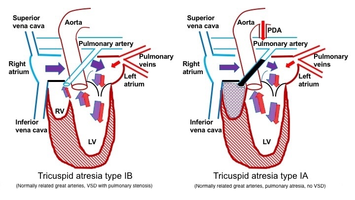 <p>Blood Flow in Patients With Pulmonary Obstruction