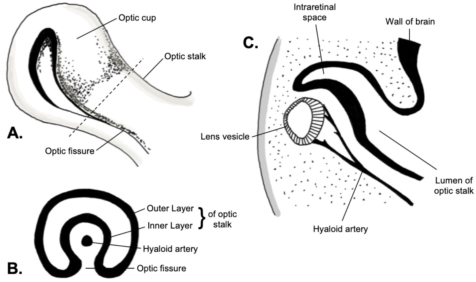 Embryology of the optic fissure. A: Lateral view. B: Coronal cross-section. C: Sagittal cross-section.