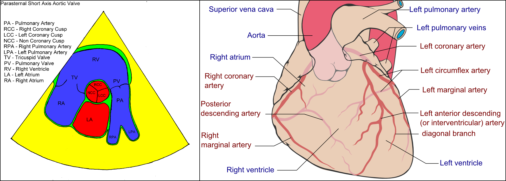 Schematic showing the origination of the coronary arteries.