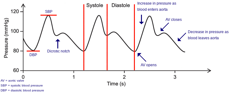 Arterial waveform