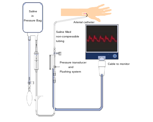 Arterial line setup