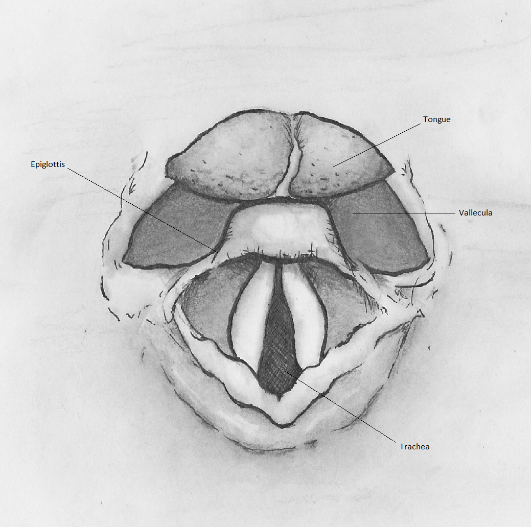 <p>Superior View of the Glottis</p>