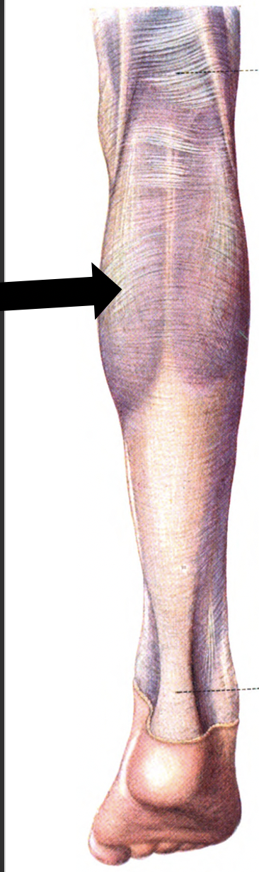 Posterior Calf