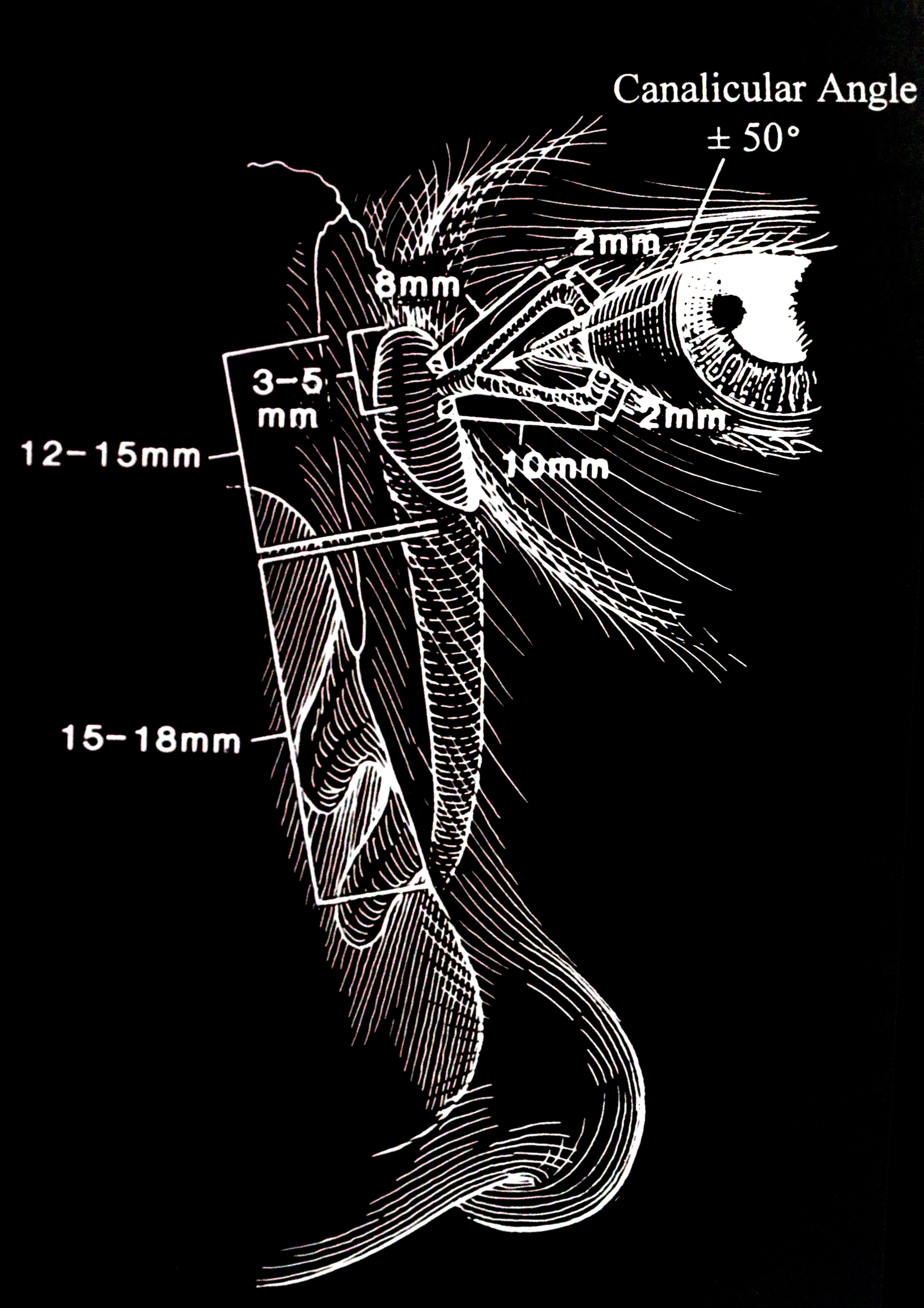 The Lacrimal Drainage Pathway: approximate measurements of the cardinal components of the adult lacrimal system