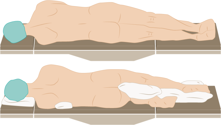 <p>Lateral Decubitus Position</p>