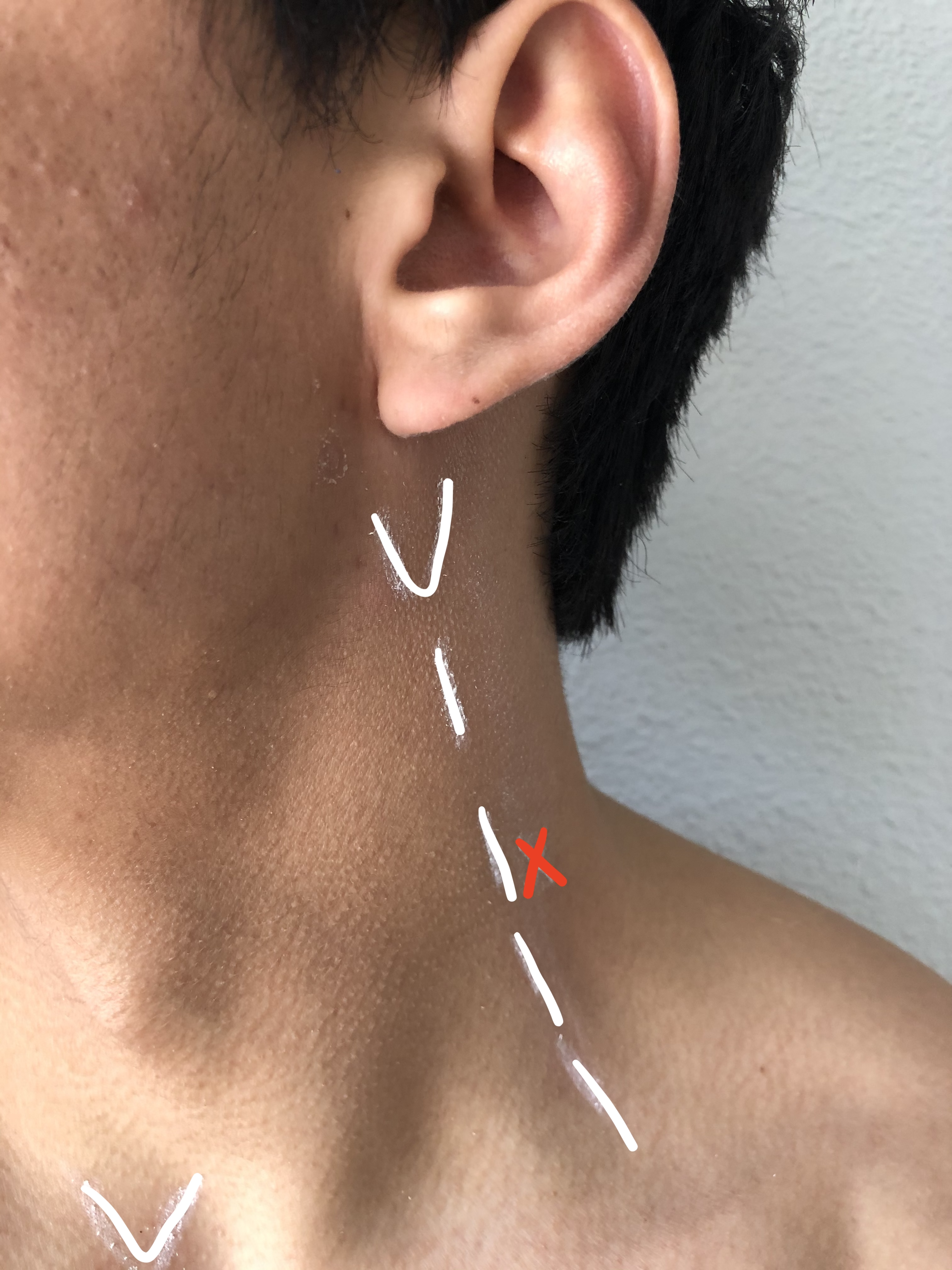 <p>Mastoid Process