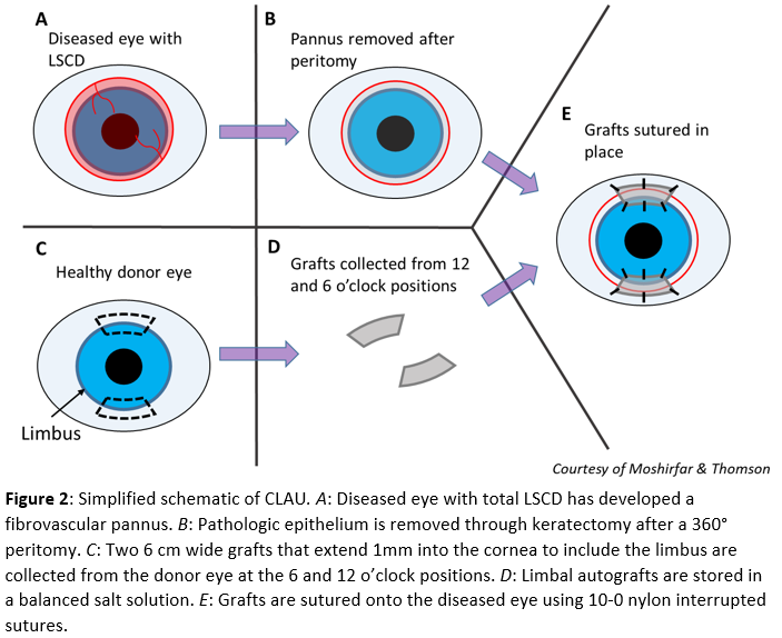 Simplified schematic of CLAU