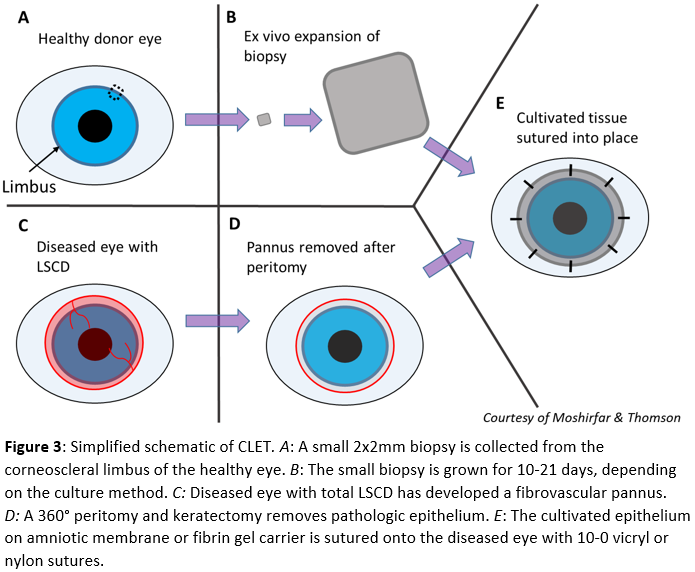 Simplified schematic of CLET