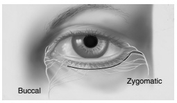 Innervation of the Orbicularis Oculi Muscle: the temporal branch supplies the lateral and superior part of the orbicularis oculi (not shown)