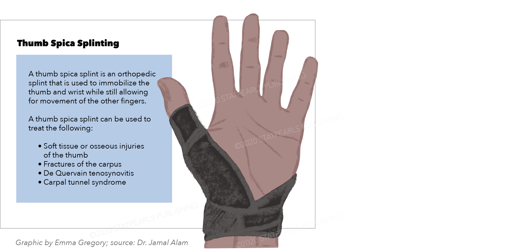 Thumb Splint graphic