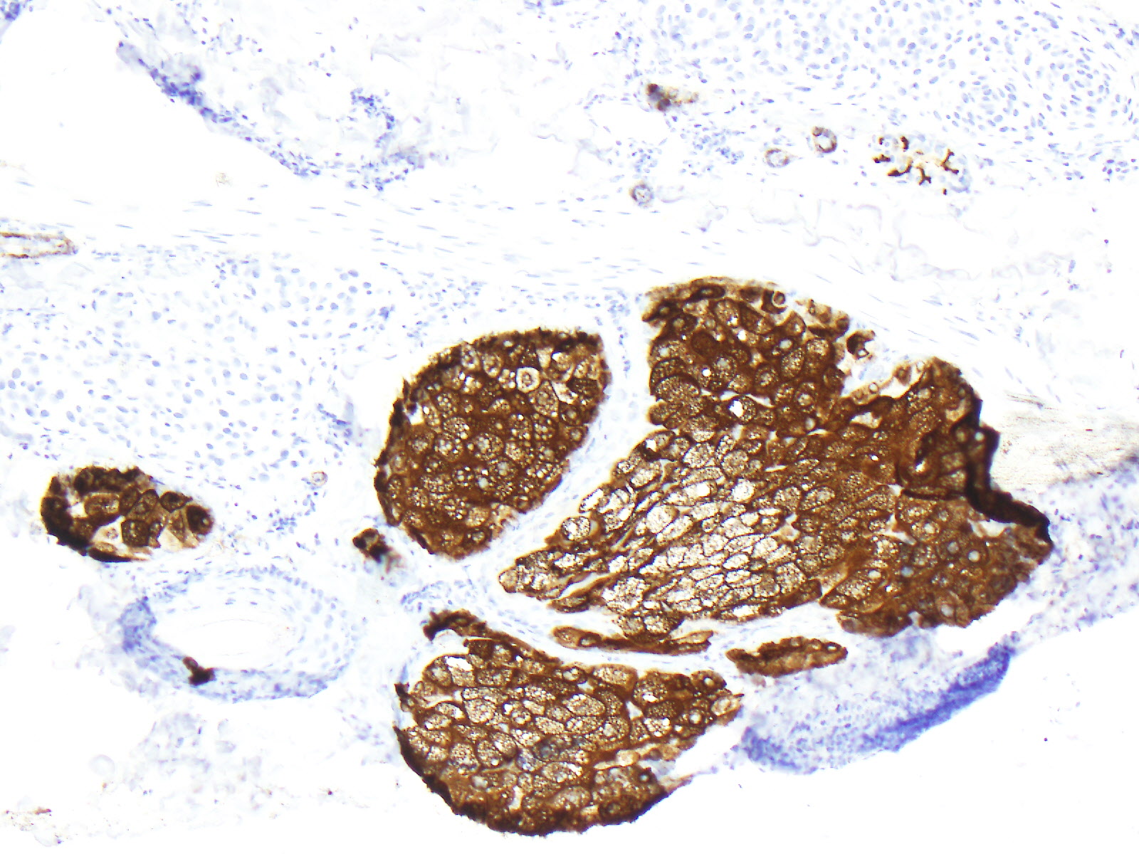 Sebaceous glands stained for EMA (epithelial membrane antigen).