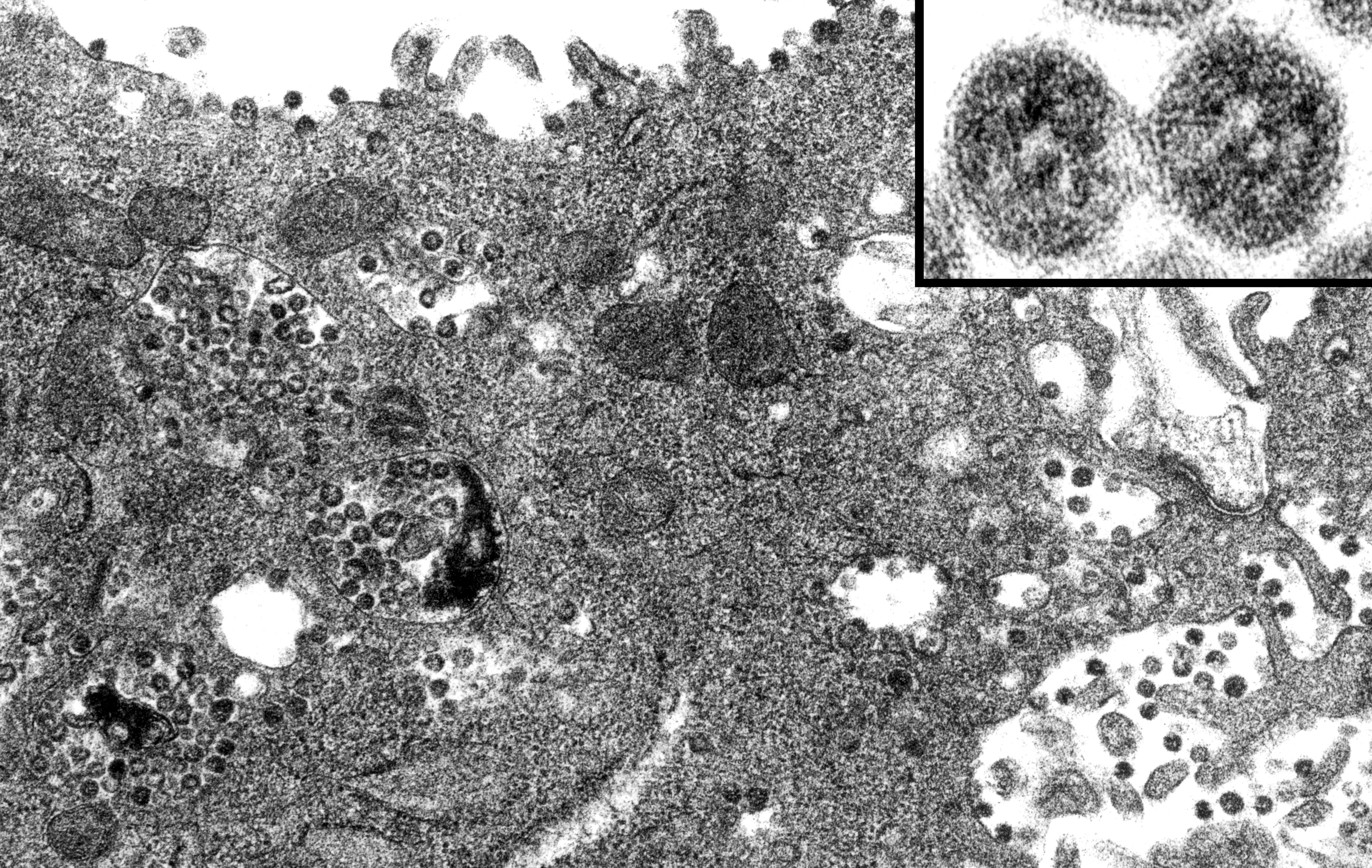 Microscopy of Rough Endoplasmic Reticulum