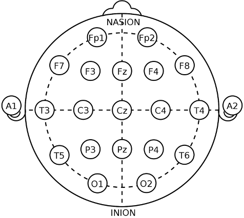 <p>International 10-20 System for Surface Electrode Placement</p>