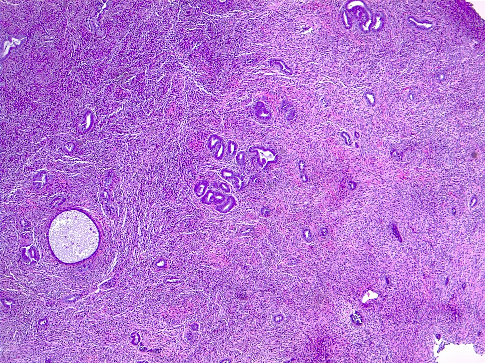 Endometrium, 4x H/E