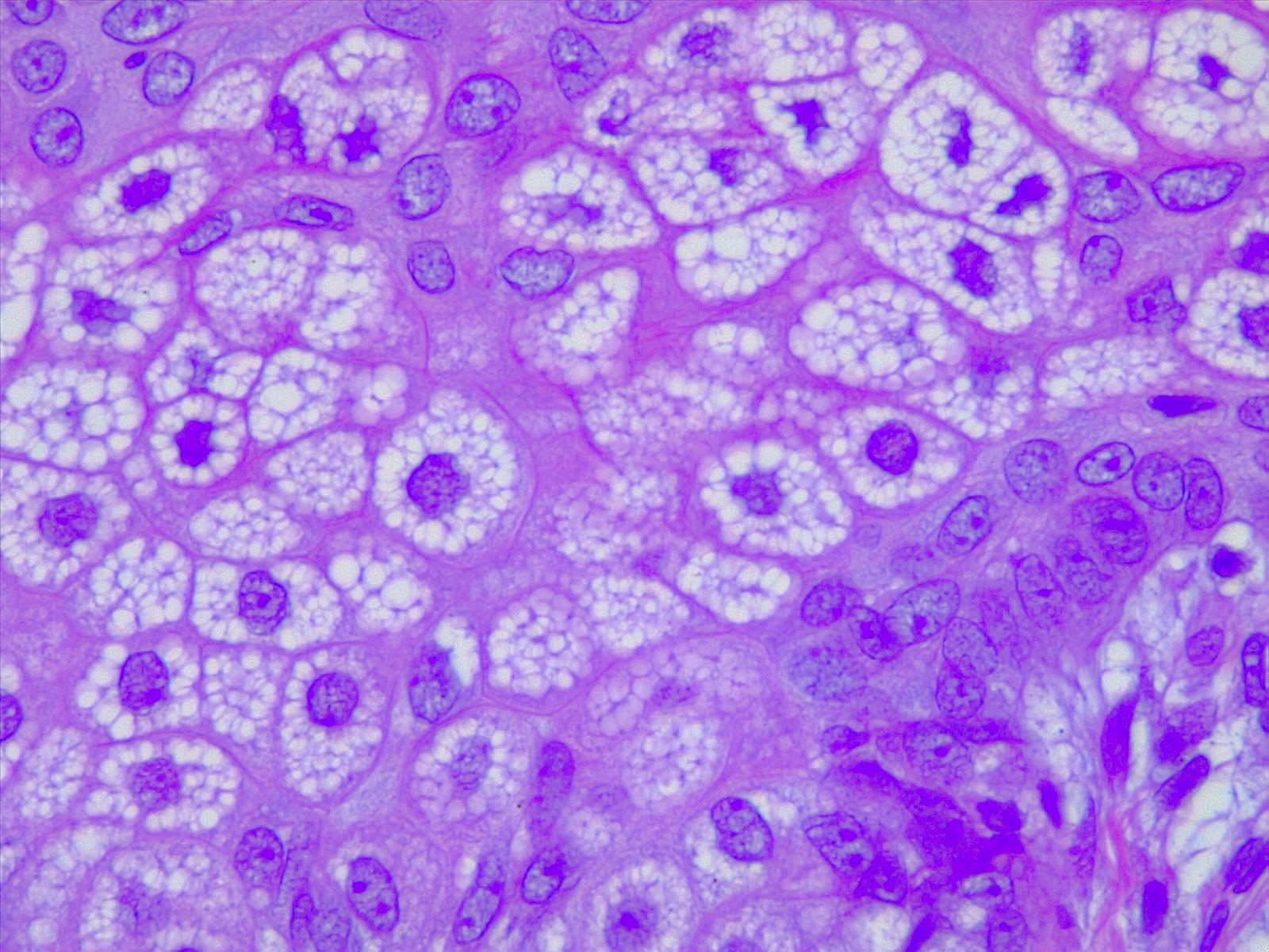 <p>Sebocytes, Sebaceous Gland Cells. H/E 40&times; Magnification.</p>