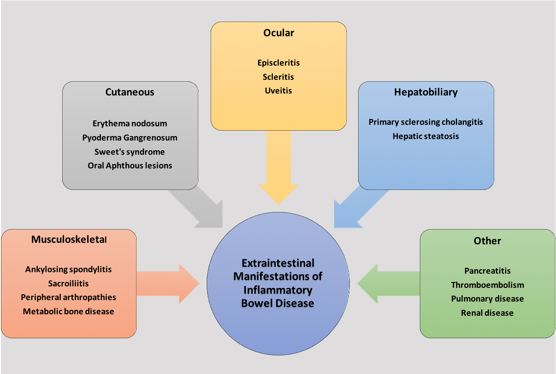 <p>Extraintestinal Manifestations of Inflammatory Bowel Disease.</p>