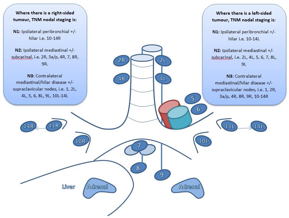 <p>Lymph Node Station.&nbsp;</p>