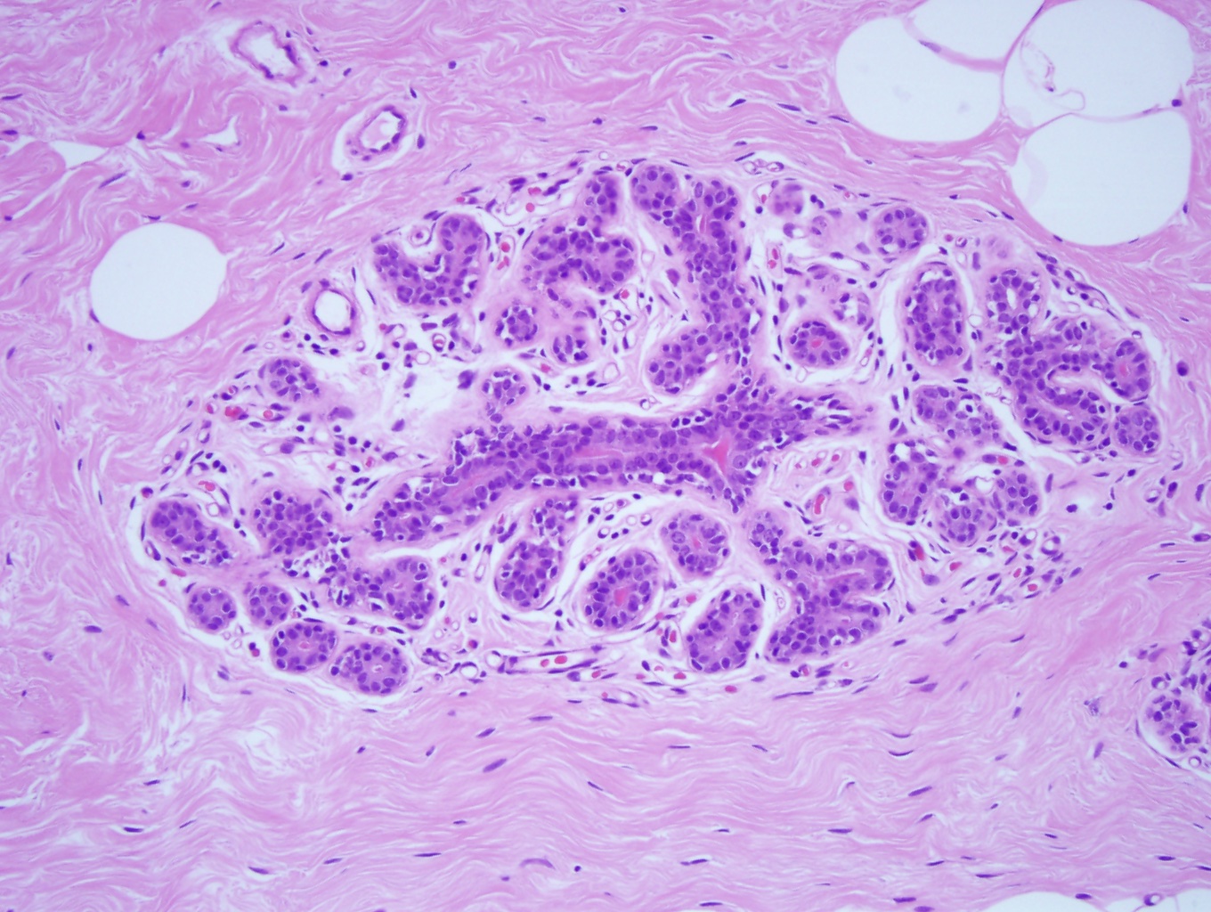 <p>Terminal Duct Lobular Unit