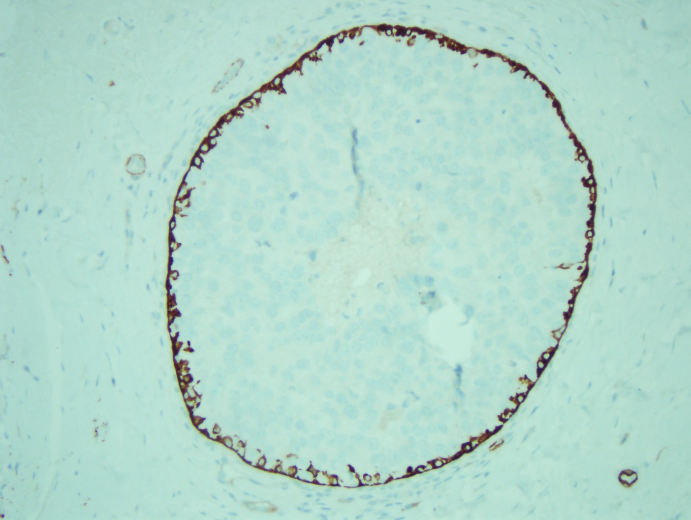 <p>Myoepithelial Cell Layer