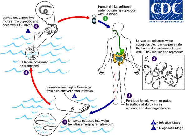 Dracunculiasis Life Cycle