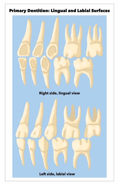 Lingual and labial surfaces of the primary dentition