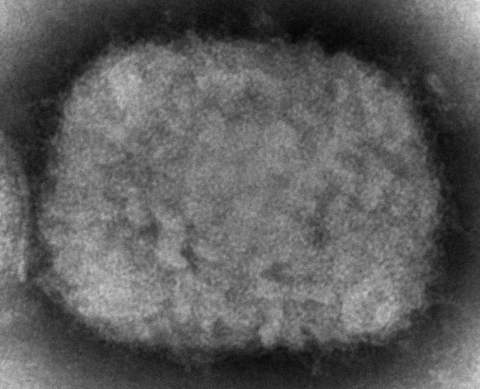 <p>Poxvirus, Electron Microscopy</p>