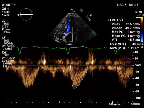 <p>Echo B</p>