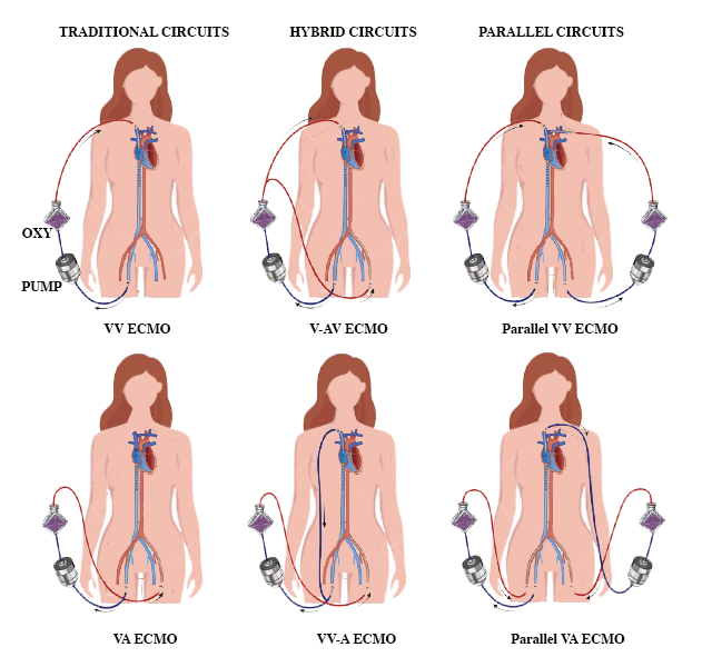 <p>Type of ECMO Circuits