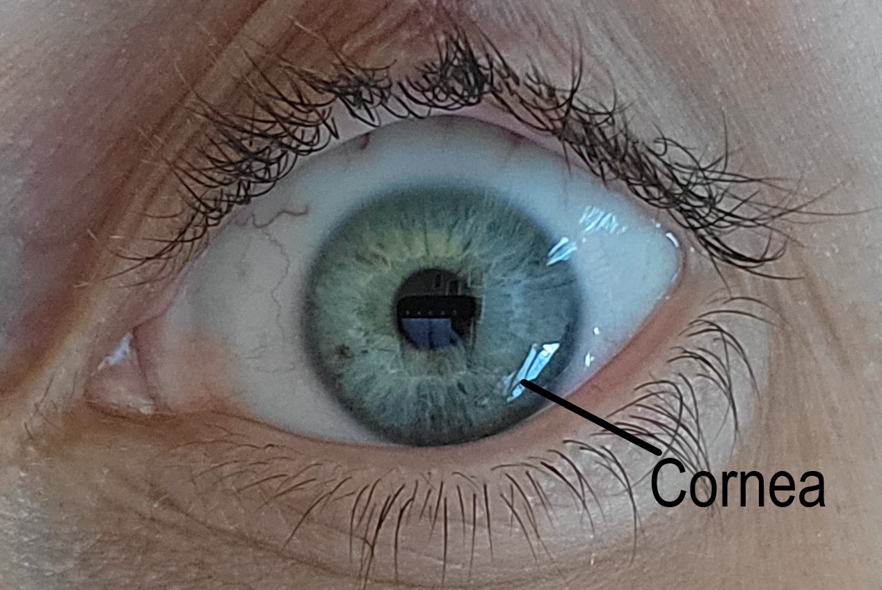 <p>Normal Cornea. A normal cornea that is transparent, avascular, and acts as a barrier to infection.</p>