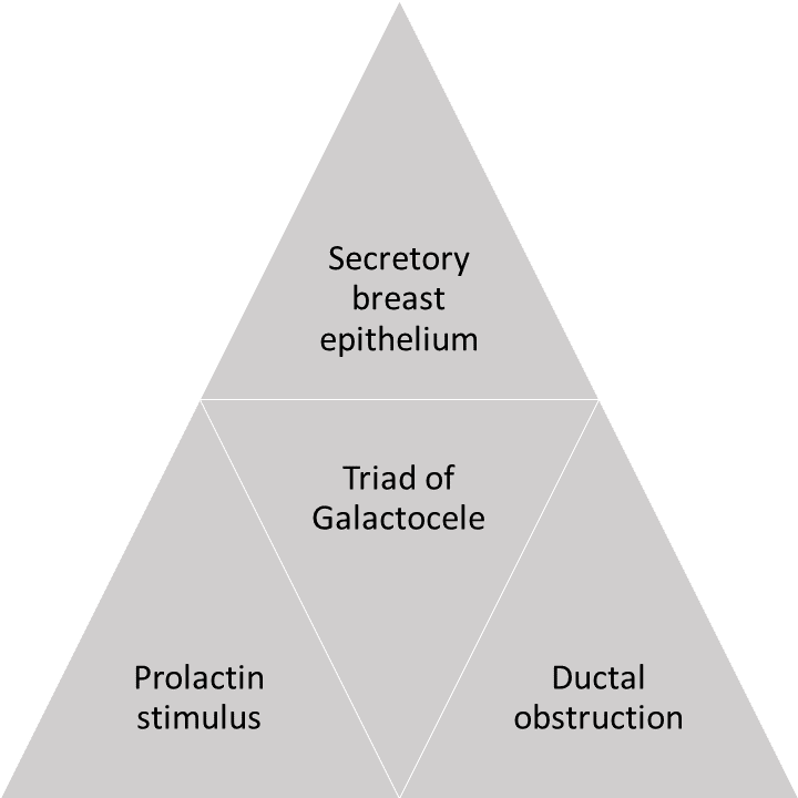 The presence of the triad of secretory breast epithelium, prolactin stimulus, and ductal obstruction is needed for the formation of galactocele