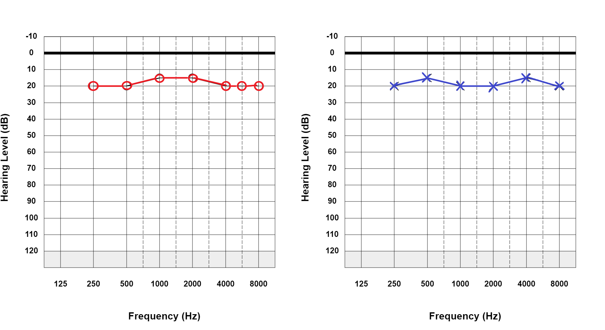 <p>Normal Hearing Thresholds. Pure tone audiogram showing normal hearing thresholds. Masking is not required.</p>