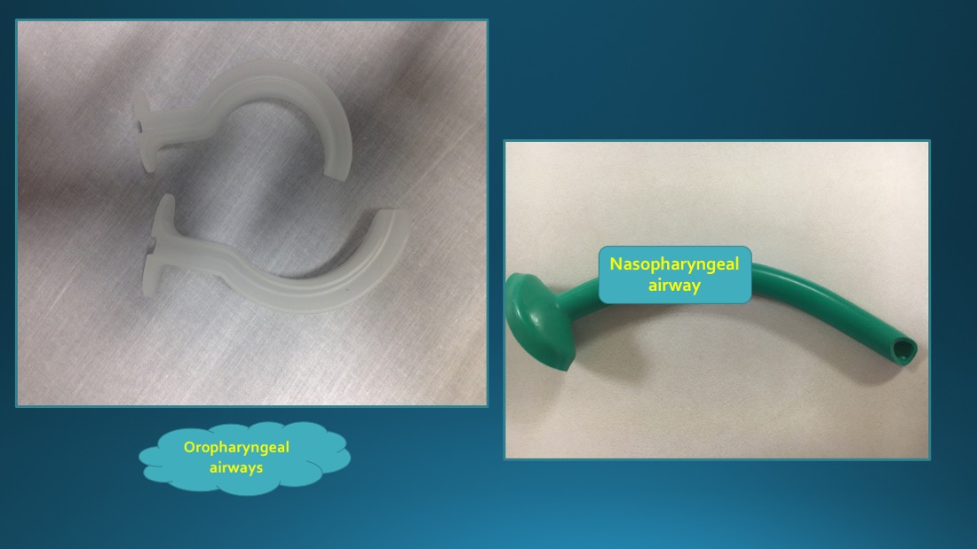 Airway Adjuncts both oropharyngeal and nasopharyngeal examples