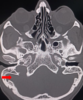 Pars vascularis