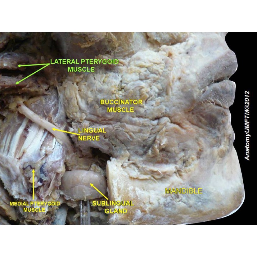 <p>Lingual Nerve and its Anatomical Relations.</p>