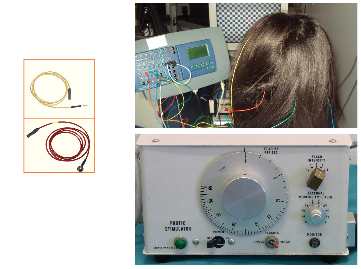 Visual evoked potentials (VEPs) using a chessboard stimulation