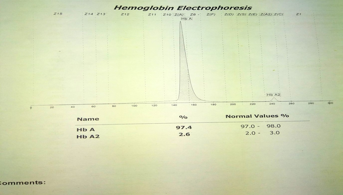Normal Hemoglobin electrophoresis