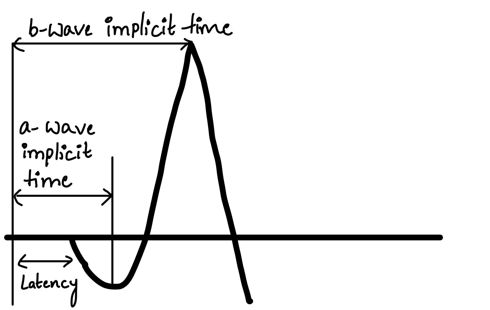 Time response of ERG waves