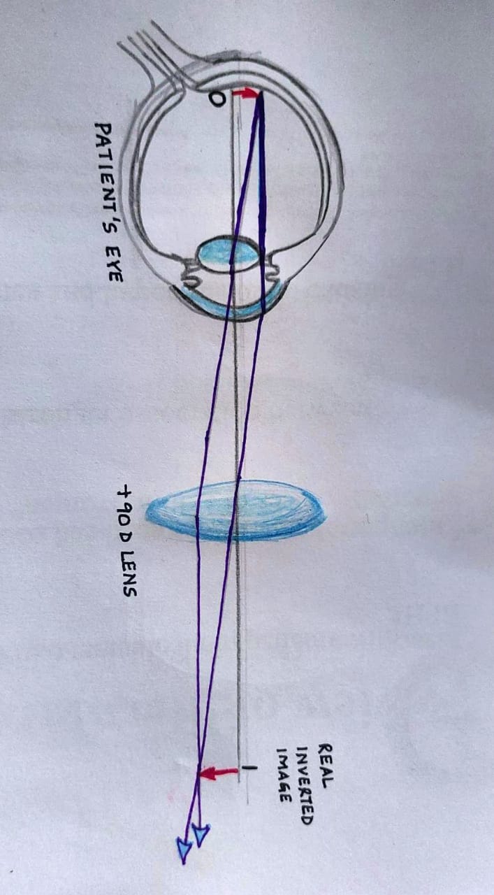 Fig 3 90D lens