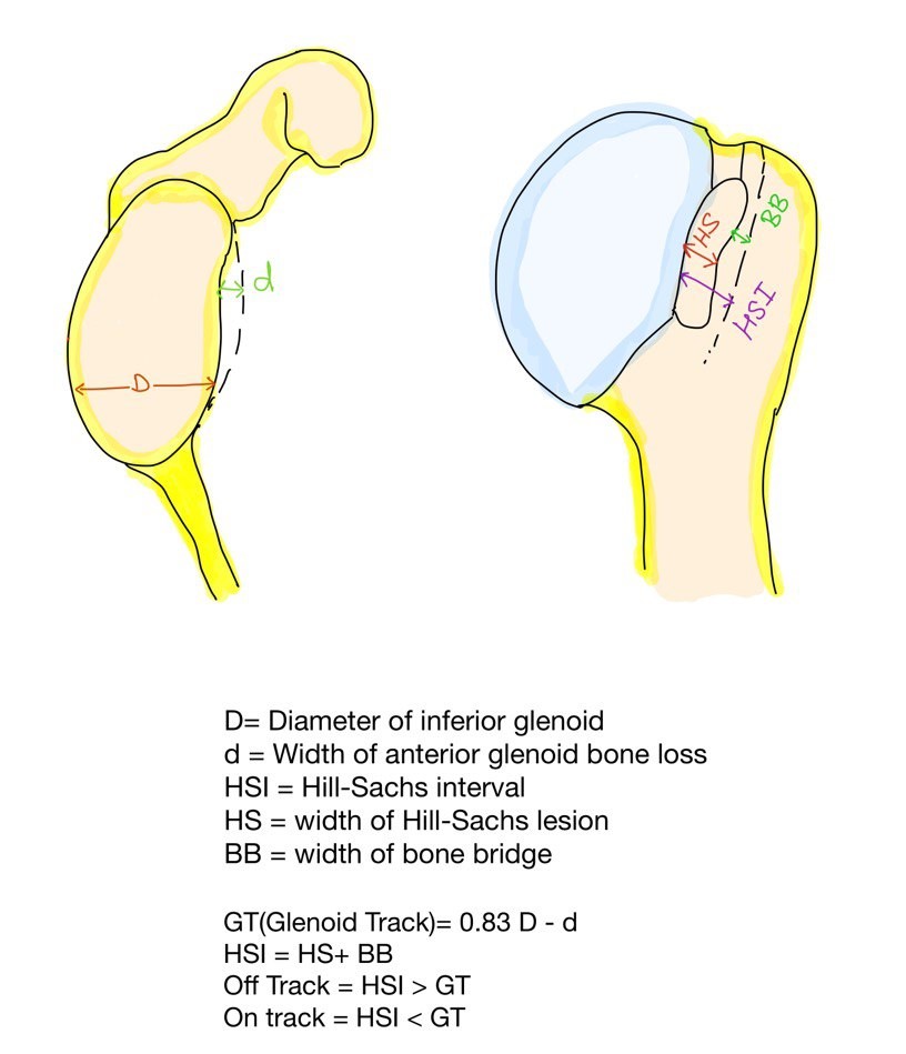 This image shows calculations of bone loss based on 3D reconstruction CT scan.