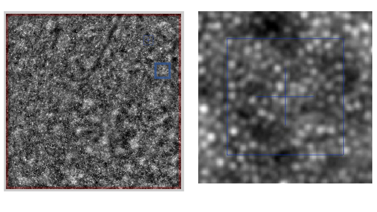 Imaging of photoreceptors with adaptive optics