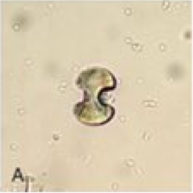 <p>Calcium Oxalate Monohydrate Crystals