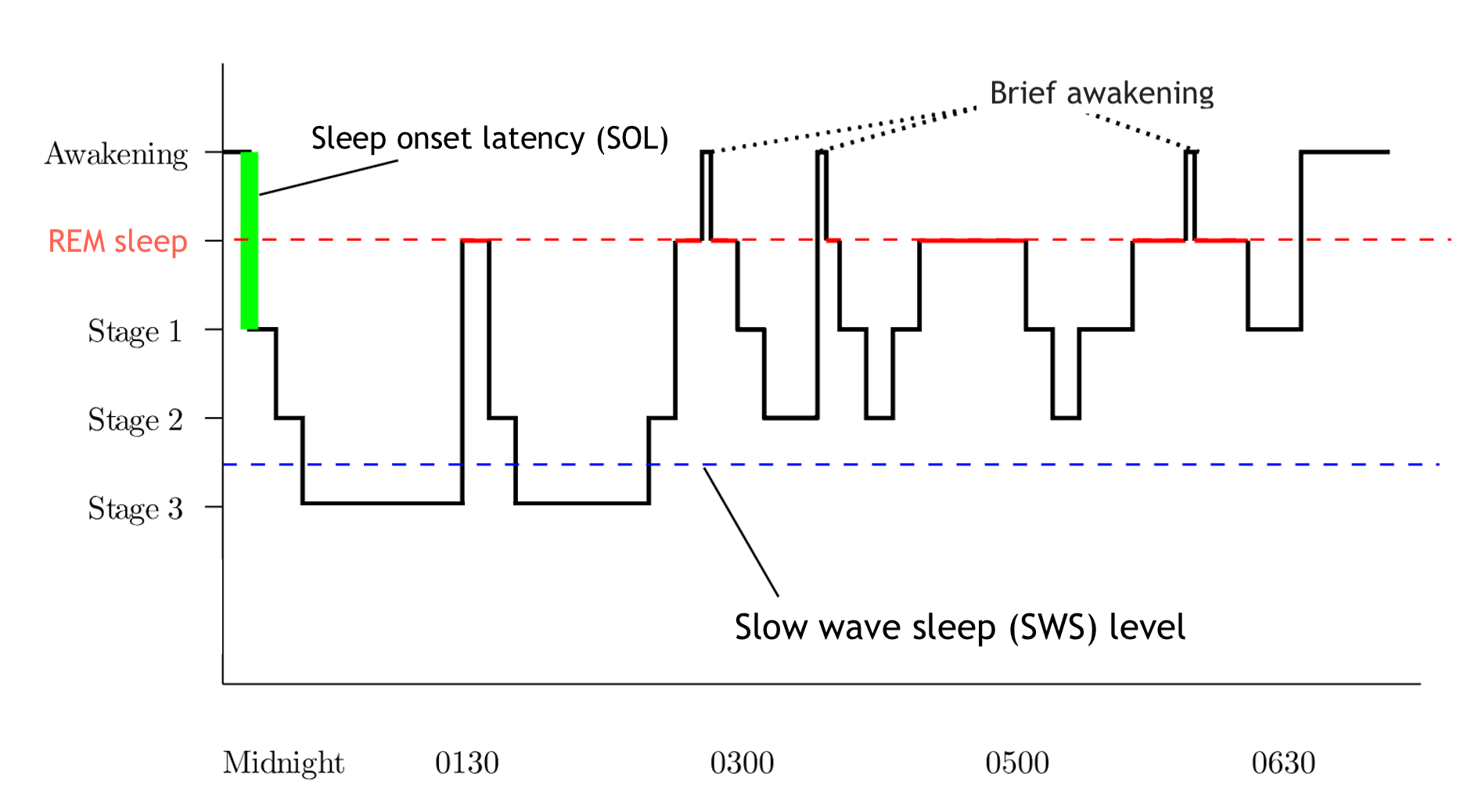 <p>Stages of Sleep Hypnogram